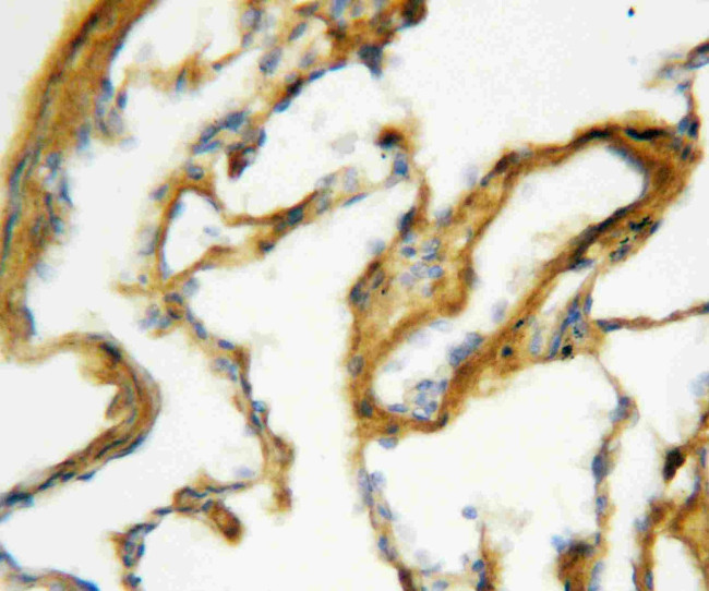 SFTPA1 Antibody in Immunohistochemistry (Paraffin) (IHC (P))