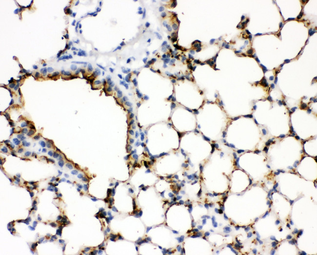 SFTPA1 Antibody in Immunohistochemistry (Paraffin) (IHC (P))