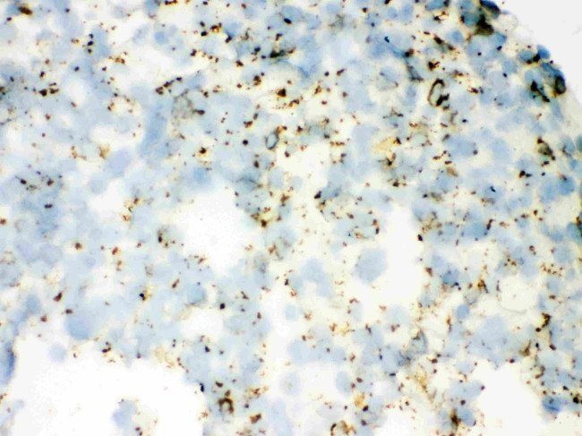 SFTPA1/SFTPA2 Antibody in Immunohistochemistry (Frozen) (IHC (F))