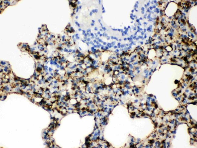 SFTPA1/SFTPA2 Antibody in Immunohistochemistry (Paraffin) (IHC (P))