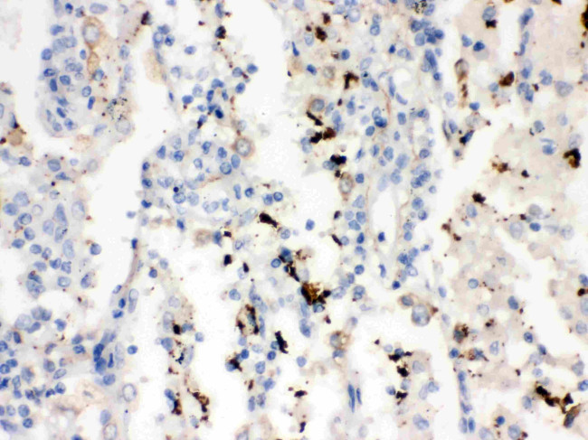 SFTPA1/SFTPA2 Antibody in Immunohistochemistry (Paraffin) (IHC (P))