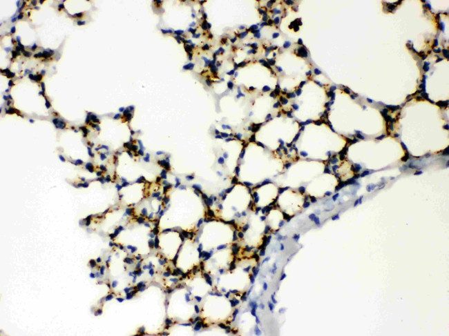 SFTPA1/SFTPA2 Antibody in Immunohistochemistry (Paraffin) (IHC (P))