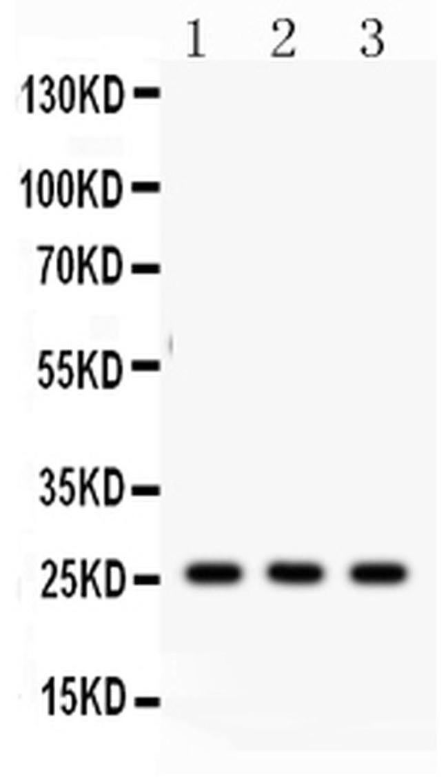 SFTPA1/SFTPA2 Antibody in Western Blot (WB)