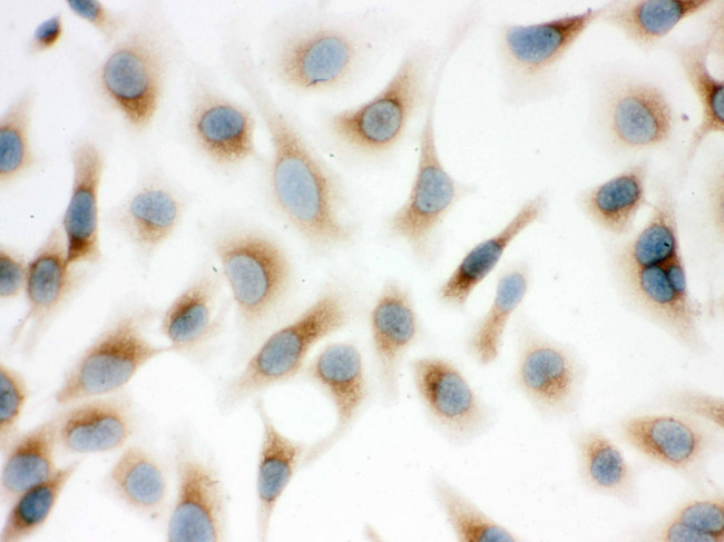 SFTPD Antibody in Immunocytochemistry (ICC/IF)