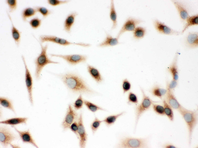 SFTPD Antibody in Immunocytochemistry (ICC/IF)