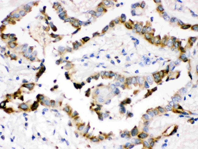 SFTPD Antibody in Immunohistochemistry (Paraffin) (IHC (P))