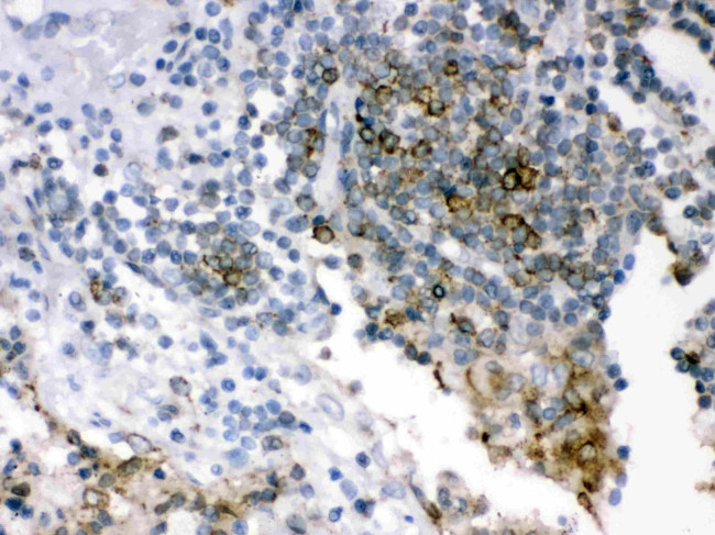 SHC Antibody in Immunohistochemistry (Paraffin) (IHC (P))