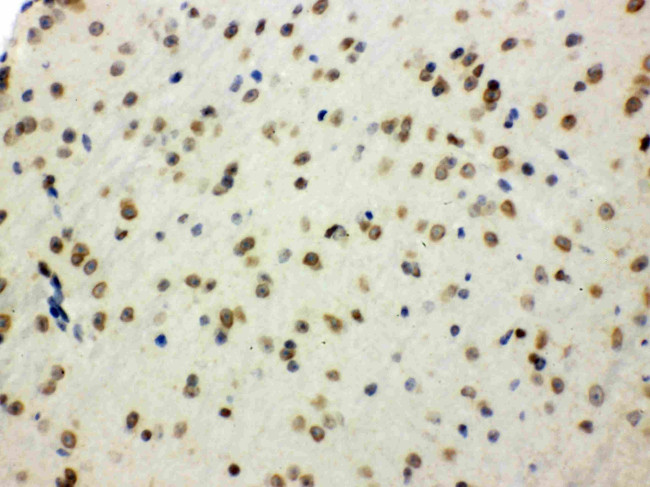 SHC Antibody in Immunohistochemistry (Paraffin) (IHC (P))