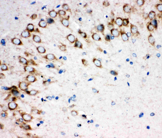 SHH Antibody in Immunohistochemistry (Paraffin) (IHC (P))