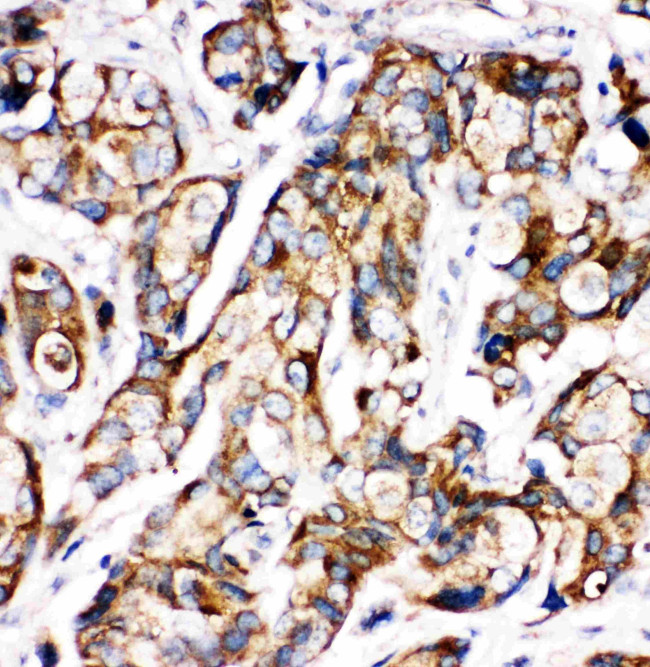 SHH Antibody in Immunohistochemistry (Paraffin) (IHC (P))