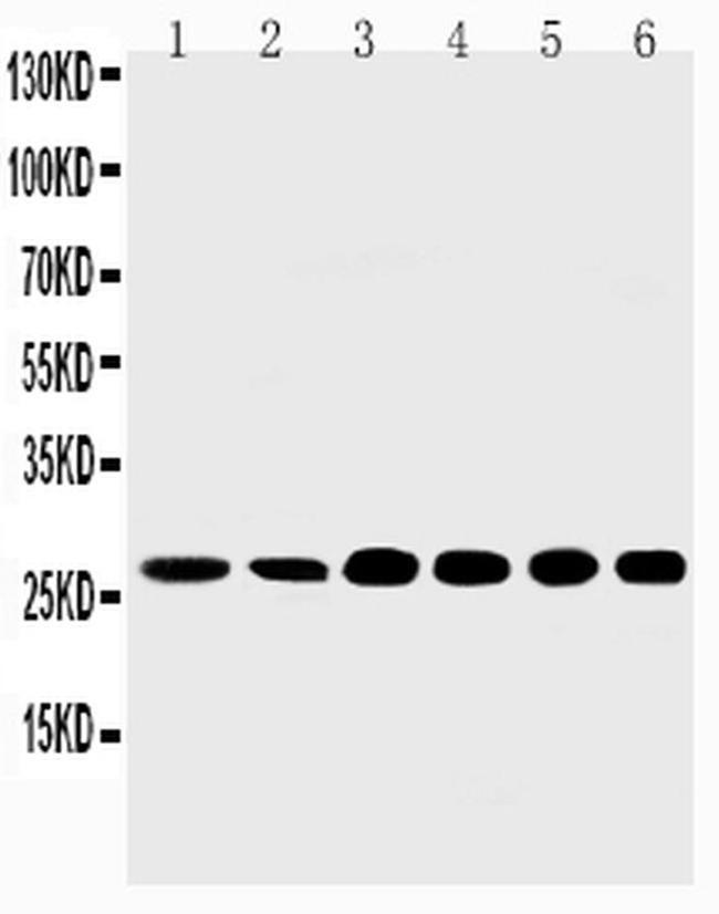 SHH Antibody in Western Blot (WB)