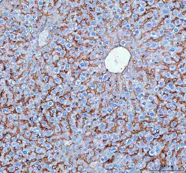 NTCP Antibody in Immunohistochemistry (Paraffin) (IHC (P))