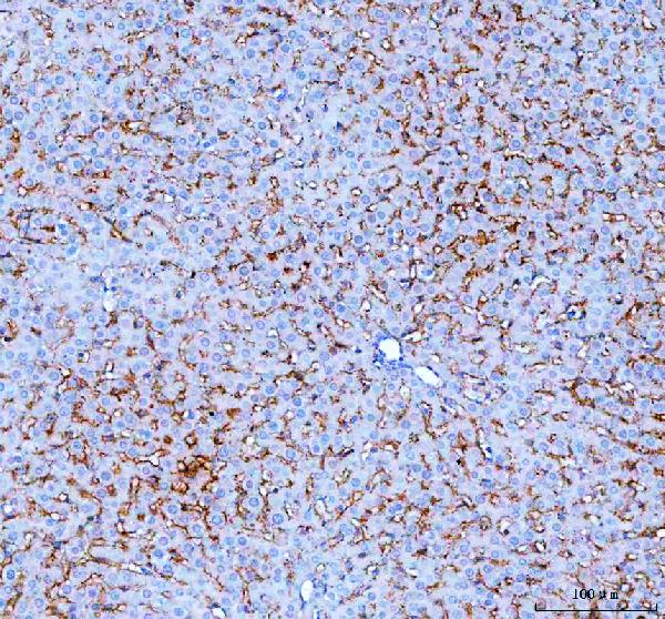 NTCP Antibody in Immunohistochemistry (Paraffin) (IHC (P))