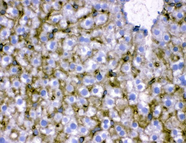 NTCP Antibody in Immunohistochemistry (Frozen) (IHC (F))