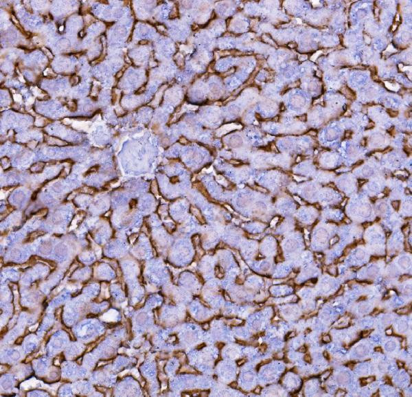 NTCP Antibody in Immunohistochemistry (Paraffin) (IHC (P))