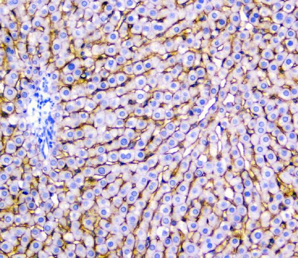 NTCP Antibody in Immunohistochemistry (Paraffin) (IHC (P))