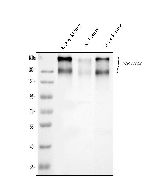 SLC12A1 Antibody in Western Blot (WB)