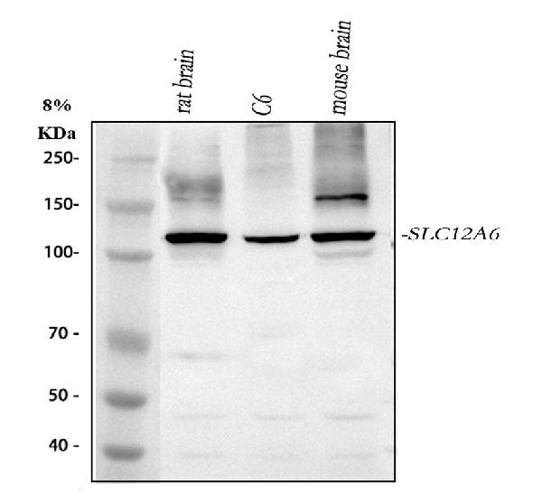 SLC12A6 Antibody in Western Blot (WB)