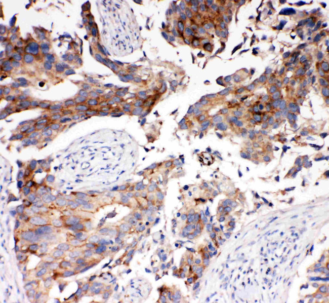 SLC16A4 Antibody in Immunohistochemistry (Paraffin) (IHC (P))