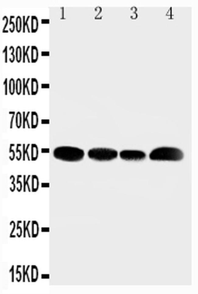 SLC16A4 Antibody in Western Blot (WB)