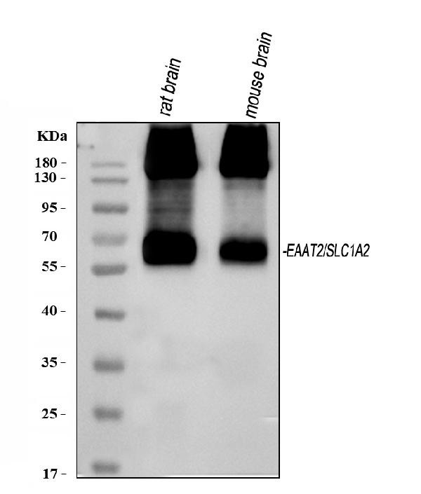 GLT-1 Antibody in Western Blot (WB)