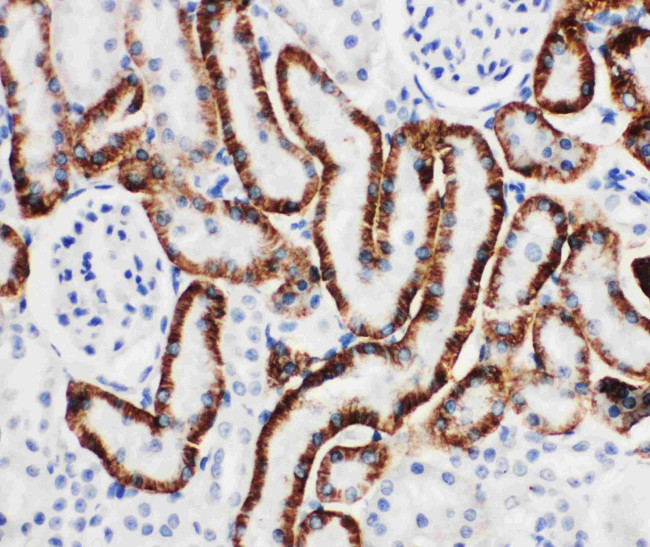 SLC22A6 Antibody in Immunohistochemistry (Paraffin) (IHC (P))