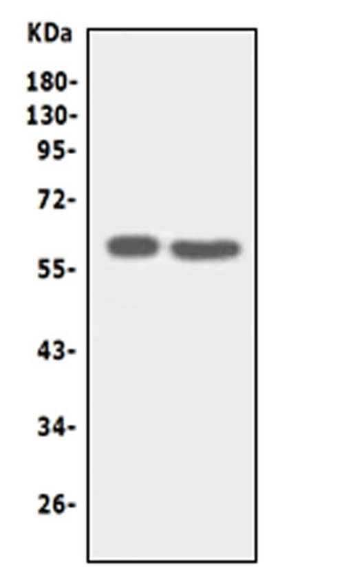 SLC22A6 Antibody in Western Blot (WB)