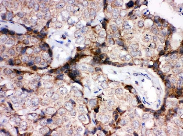 GLUT4 Antibody in Immunohistochemistry (Paraffin) (IHC (P))