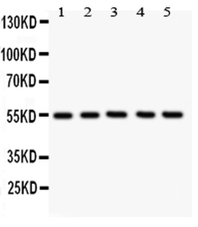 GLUT4 Antibody in Western Blot (WB)