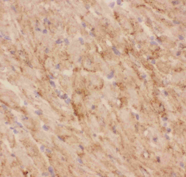 GLUT4 Antibody in Immunohistochemistry (Frozen) (IHC (F))