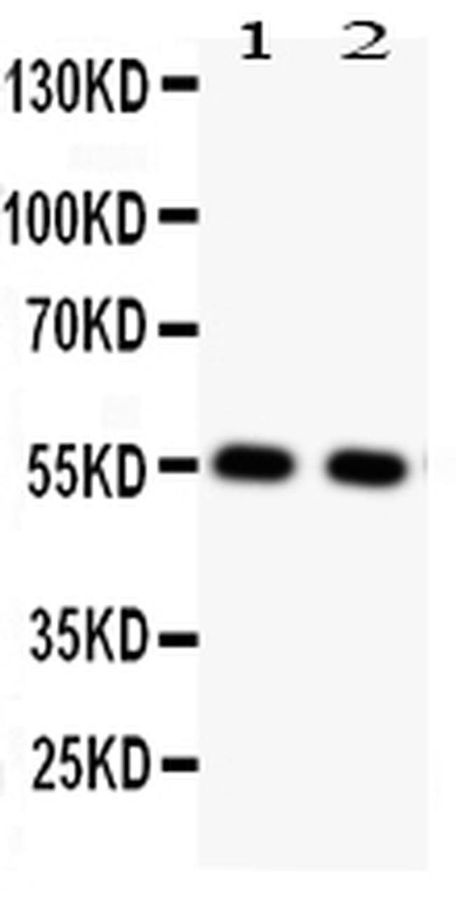 GLUT4 Antibody in Western Blot (WB)