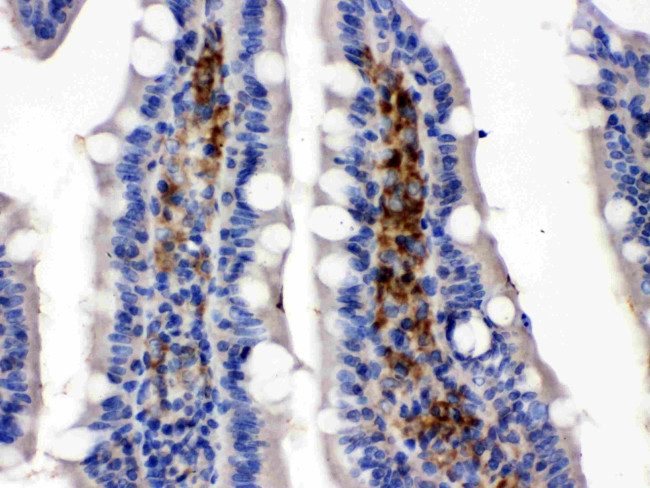 GLUT5 Antibody in Immunohistochemistry (Paraffin) (IHC (P))