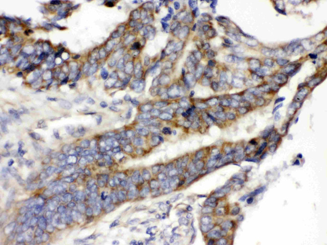 GLUT5 Antibody in Immunohistochemistry (Paraffin) (IHC (P))