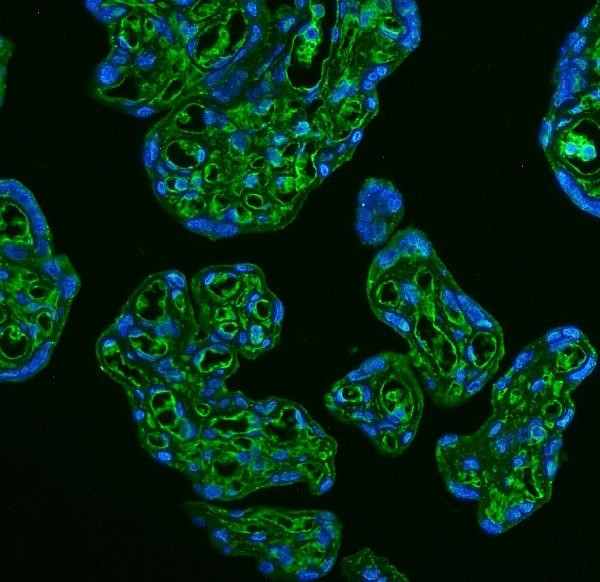 GLUT9 Antibody in Immunohistochemistry (IHC)