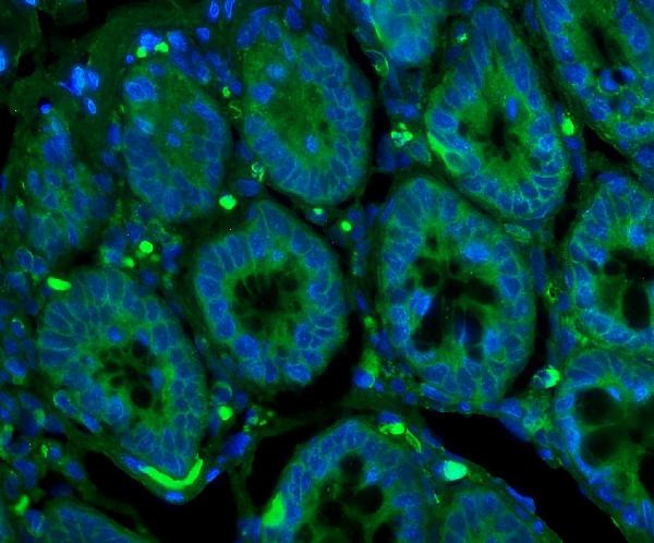 GLUT9 Antibody in Immunohistochemistry (IHC)