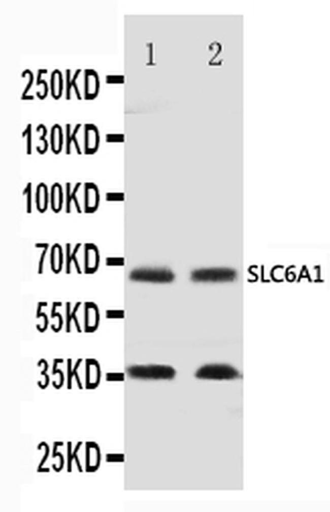 GAT-1 Antibody in Western Blot (WB)