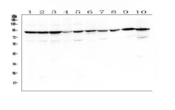 SLC6A4 Antibody in Western Blot (WB)