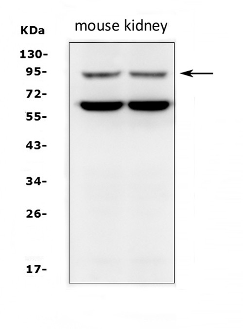 SLC9A2 Antibody in Western Blot (WB)