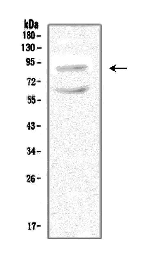 SLC9A2 Antibody in Western Blot (WB)