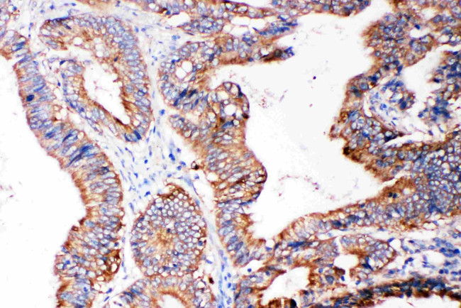 SMAD5 Antibody in Immunohistochemistry (Paraffin) (IHC (P))