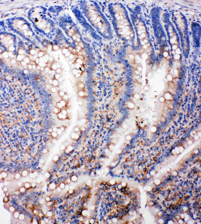 SMAD5 Antibody in Immunohistochemistry (Paraffin) (IHC (P))