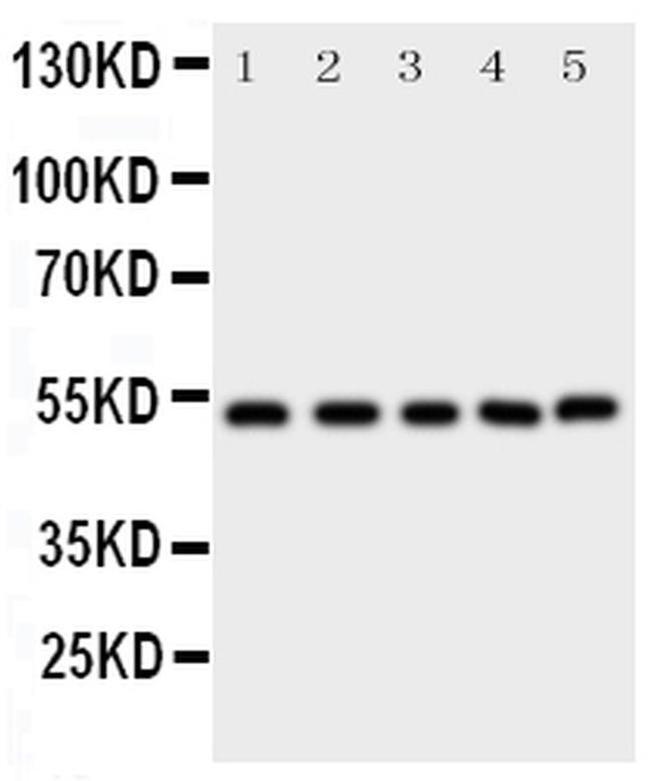 SMAD5 Antibody in Western Blot (WB)