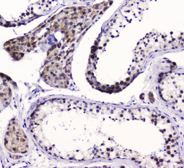 SMC6 Antibody in Immunohistochemistry (Paraffin) (IHC (P))