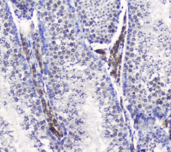 SMC6 Antibody in Immunohistochemistry (Paraffin) (IHC (P))