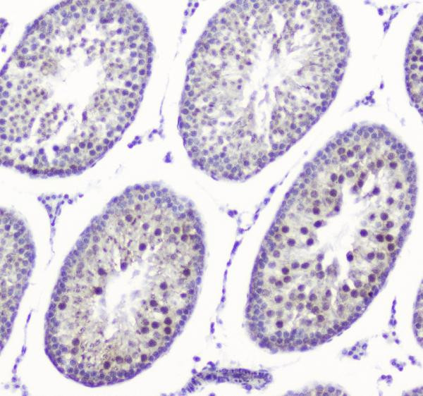 SMC6 Antibody in Immunohistochemistry (Paraffin) (IHC (P))