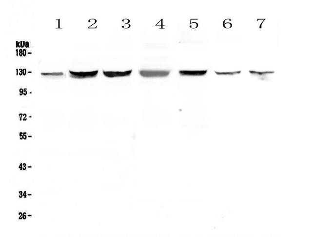 SMC6 Antibody in Western Blot (WB)