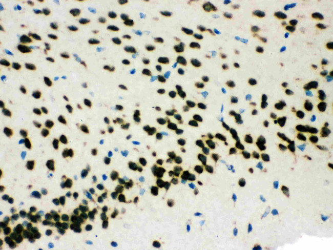 SMN1/SMN2 Antibody in Immunohistochemistry (Paraffin) (IHC (P))