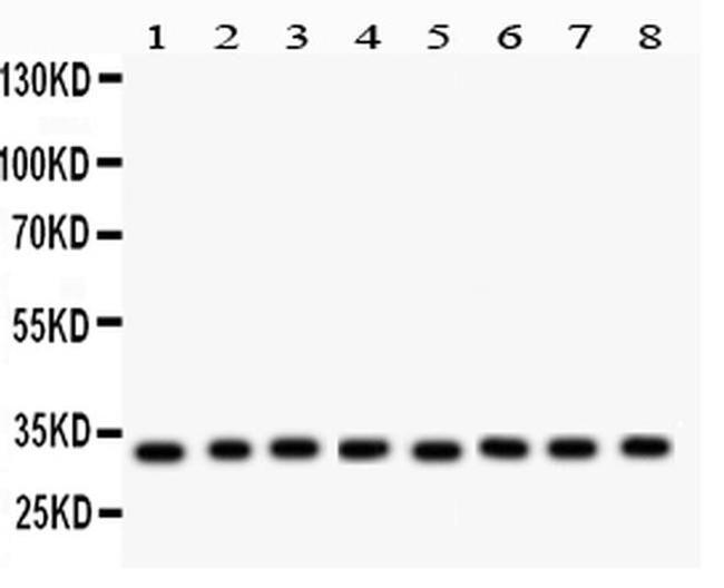 SMN1/SMN2 Antibody in Western Blot (WB)