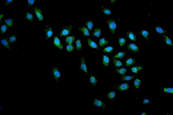 SMN1/SMN2 Antibody in Immunocytochemistry (ICC/IF)