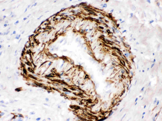 SMYD3 Antibody in Immunohistochemistry (Paraffin) (IHC (P))